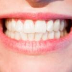 teeth-1652976_960_720[1]